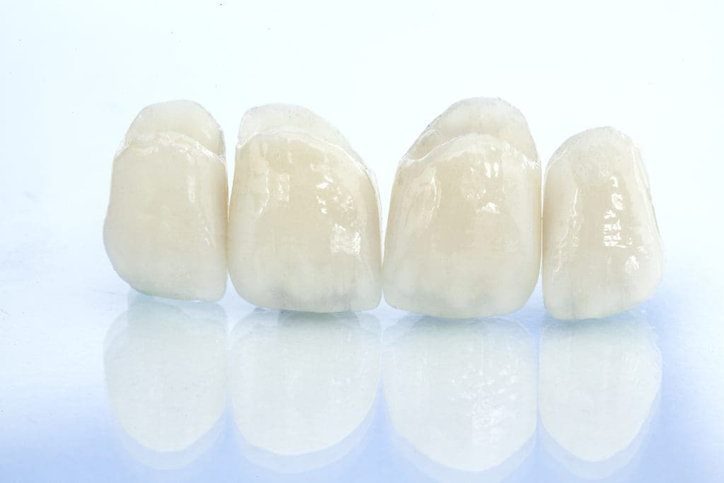 Dental Crowns