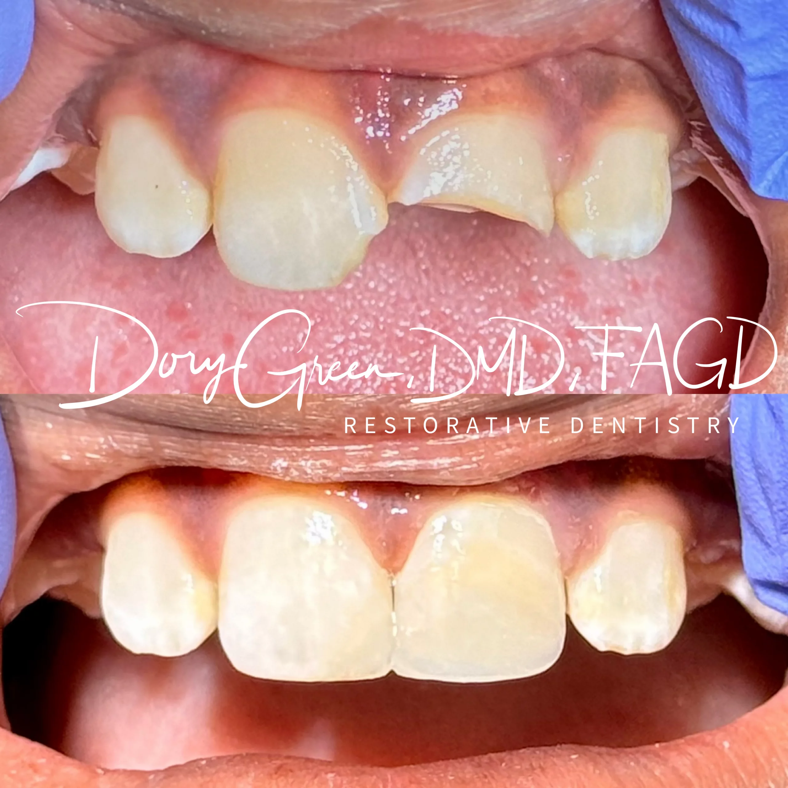 IMG 0107 scaled - DG Dental