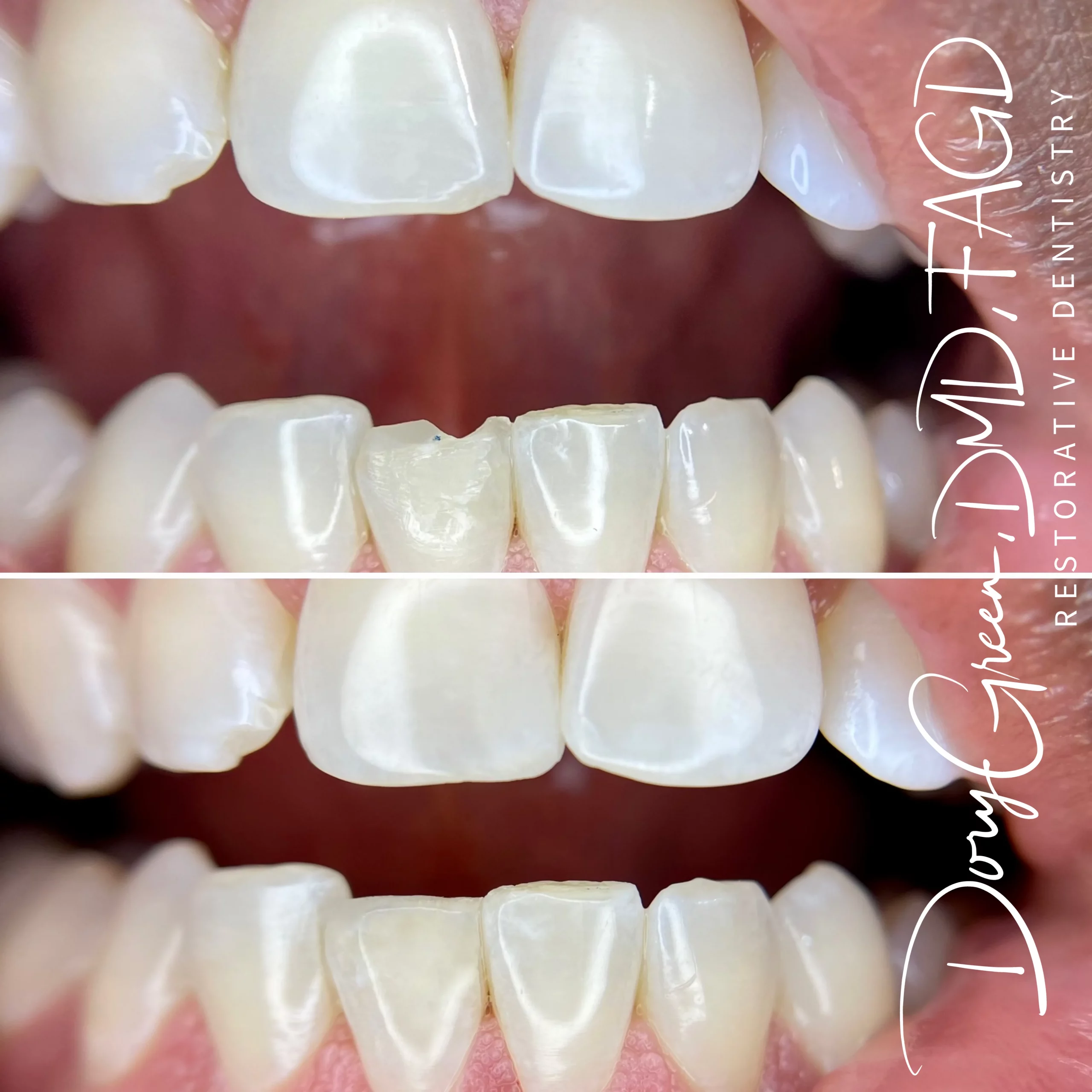 IMG 1005 scaled - DG Dental